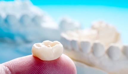 dentist in DeSoto holding a dental crown on their finger