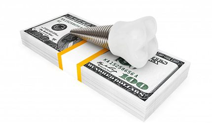 dental implant lying on top of a stack of cash 