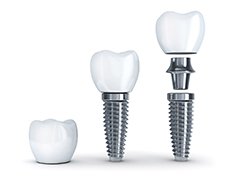 dental implant post, abutment, and crown 