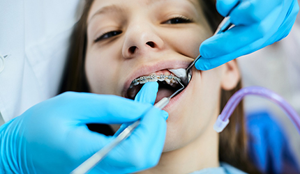 young teenage girl with braces 