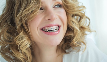 a woman smiling after getting traditional braces in DeSoto