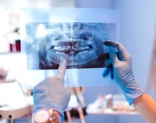 DeSoto dentist looking at patient's X-ray