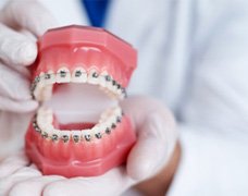 Dentist holding model of teeth with traditional braces