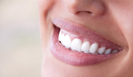 Closeup of flawless smile with porcelain veneers