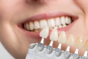 dentist matching veneers with natural teeth