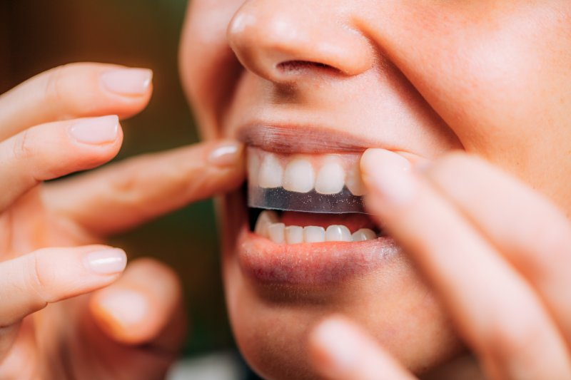 person using over-the-counter teeth whitening products