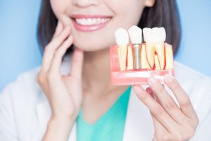 a dentist showing a replica of a dental implant