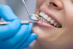 Woman at her dental cleaning appointment