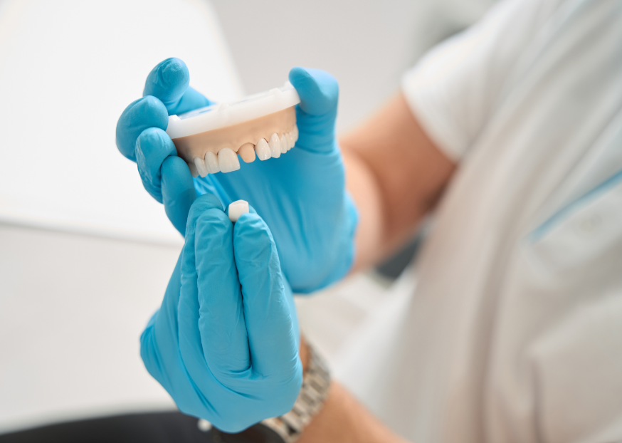Dentist holding dental crown model